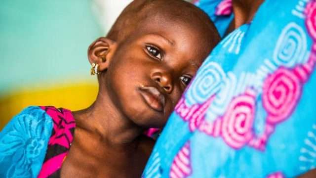 Kano State Tackles Child Malnutrition with N637 Million Investment